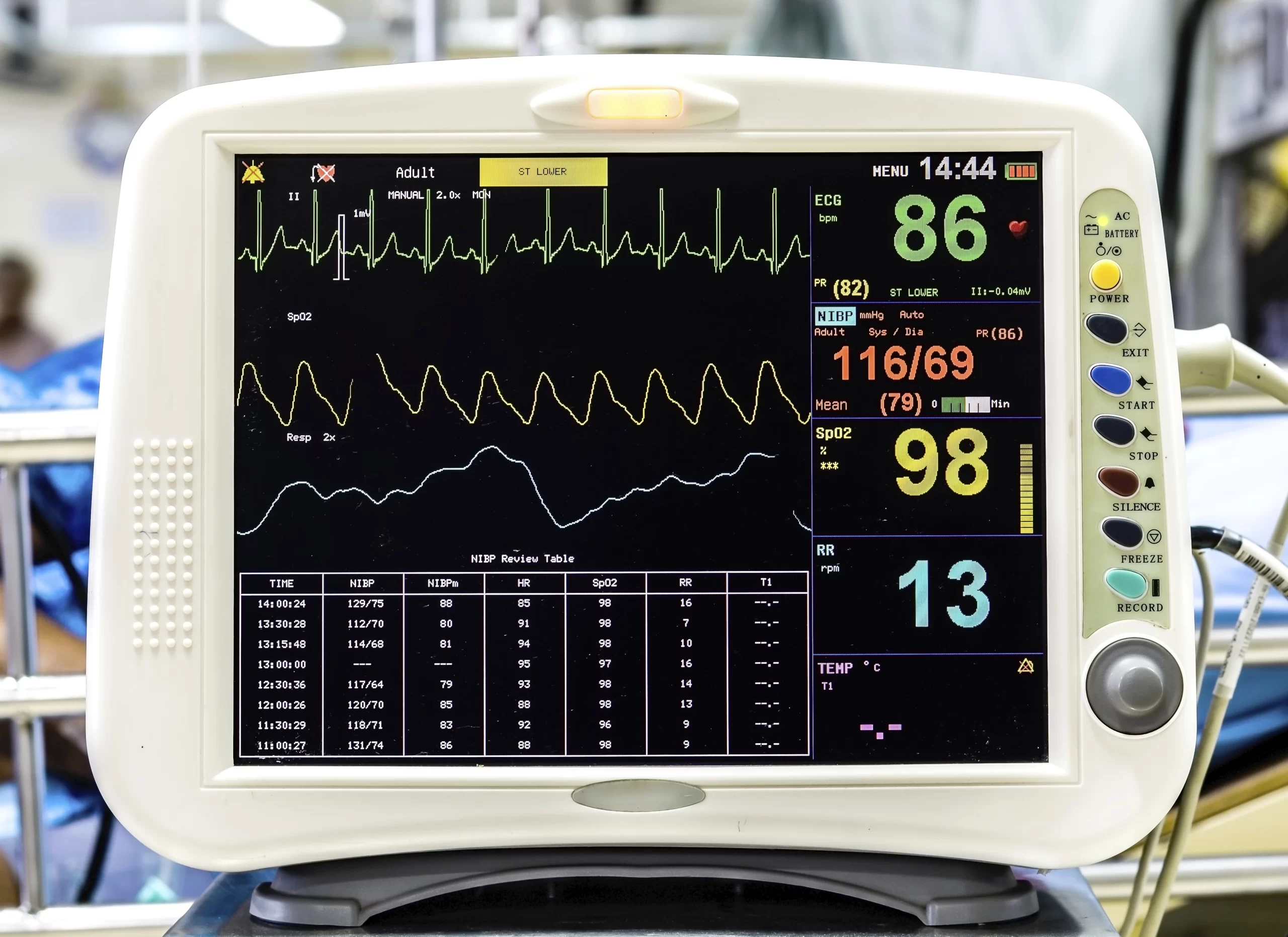 Electrocardiogram (ECG) monitor
